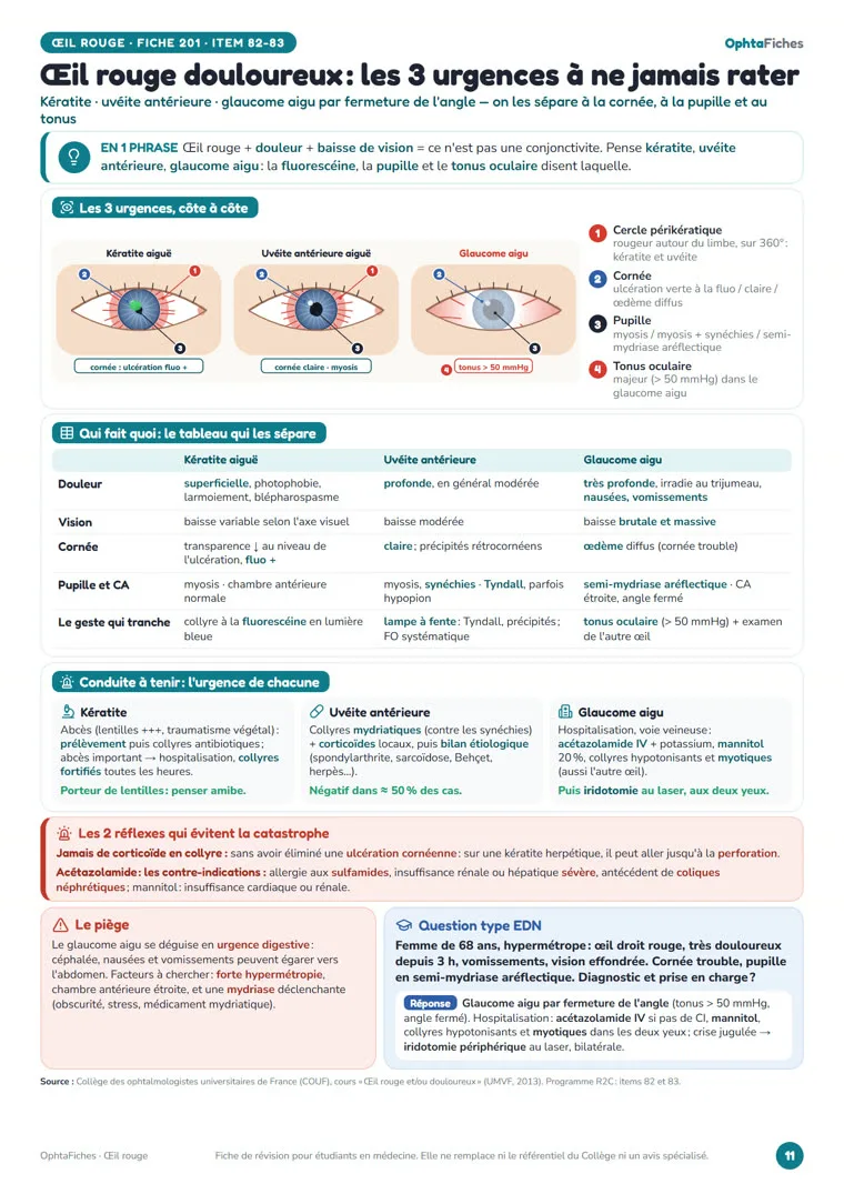 Fiche « Œil rouge douloureux : les 3 urgences à ne jamais rater » d’OphtaFiches
