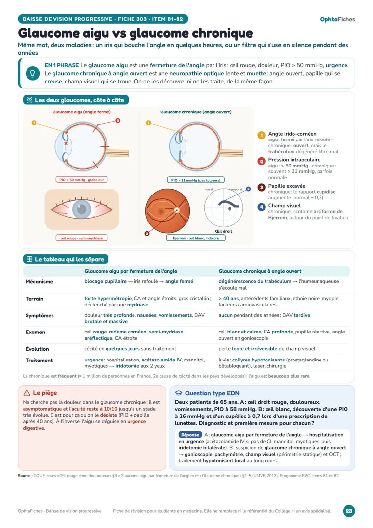 Fiche « Glaucome aigu vs glaucome chronique » d’OphtaFiches