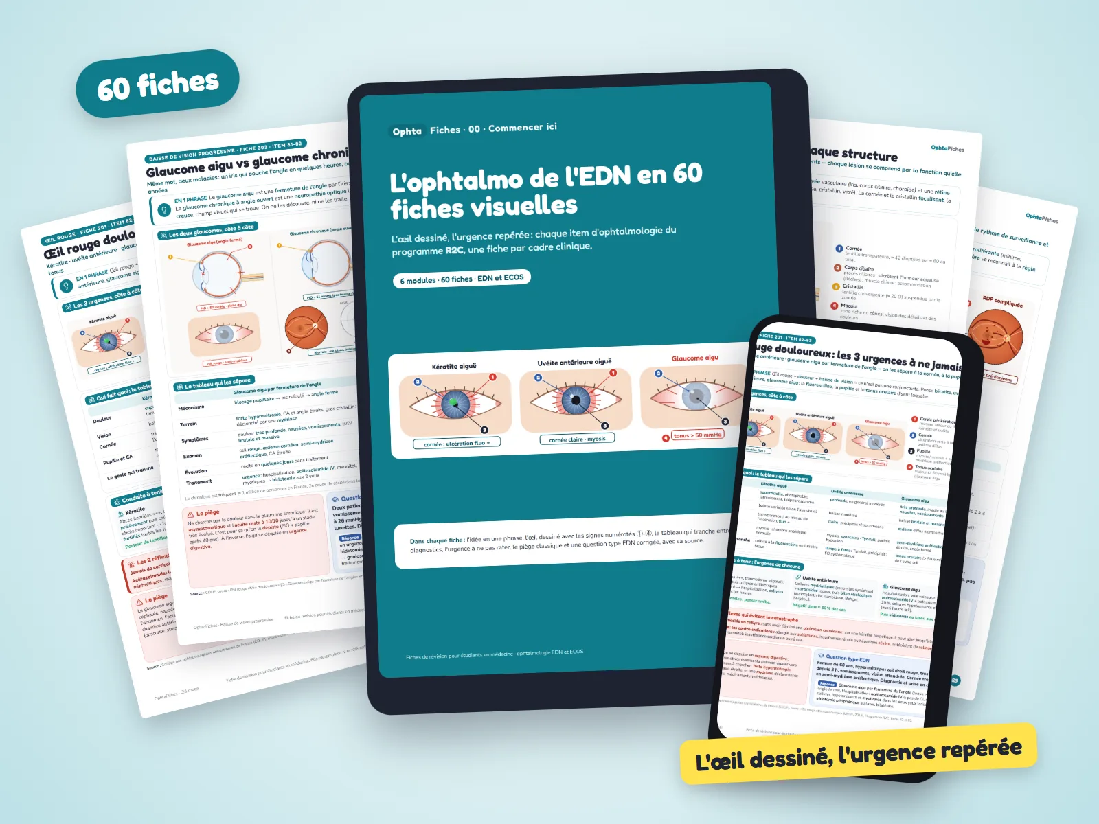 OphtaFiches : la couverture sur une tablette, une fiche sur un téléphone et plusieurs fiches autour